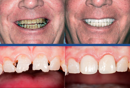 Before & after photos of cosmetic and reconstructive dentistry.